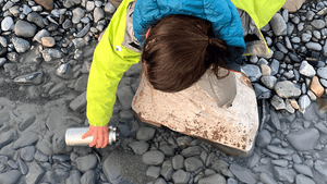 Jo's Shoulder Out Of Socket